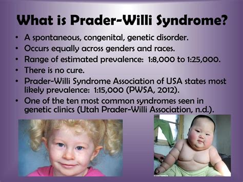 prader willi syndrome inherited